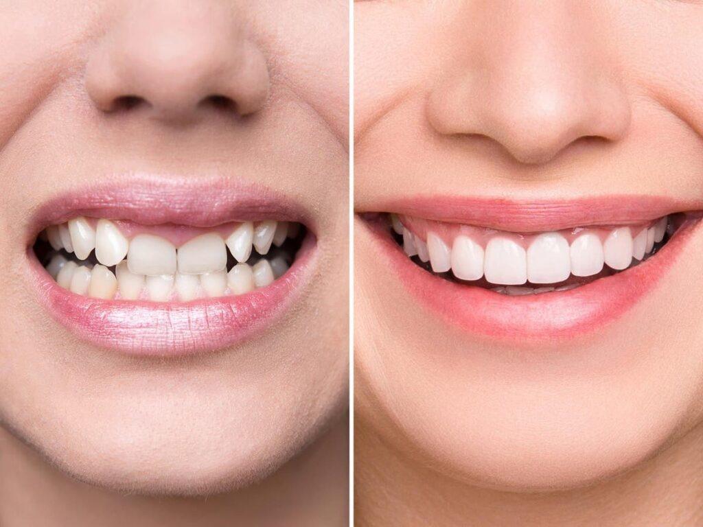 Digital Smile Design